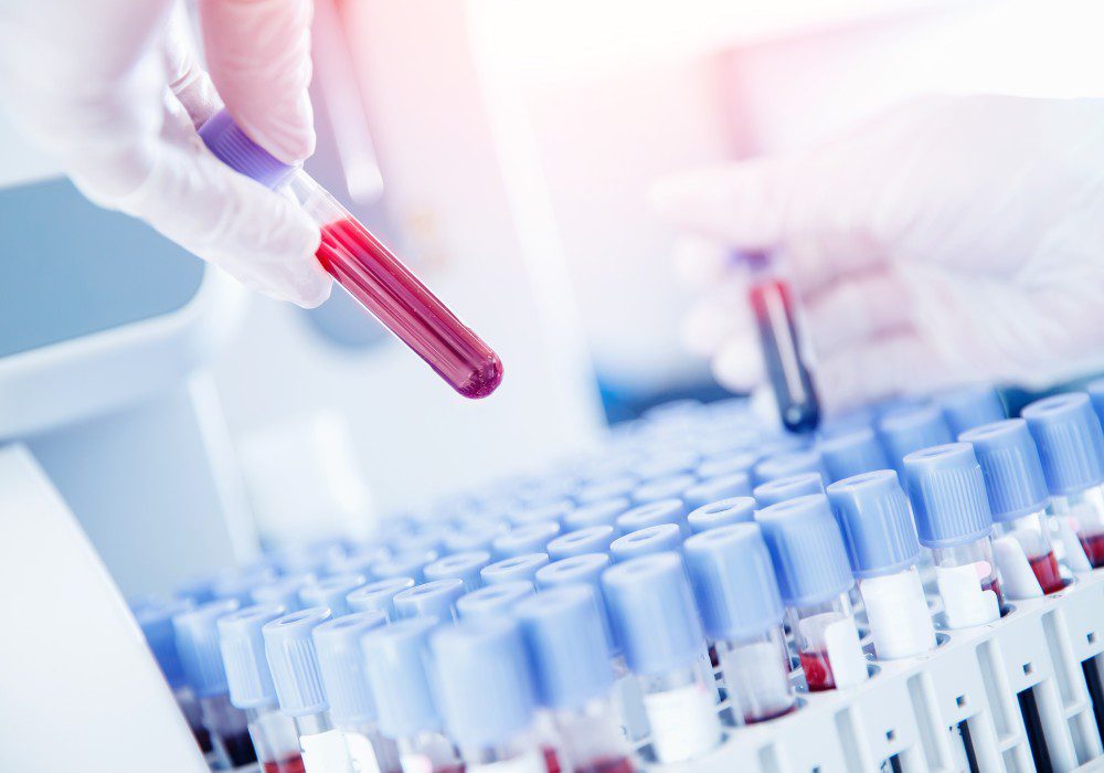 Lab worker preparing test blood .