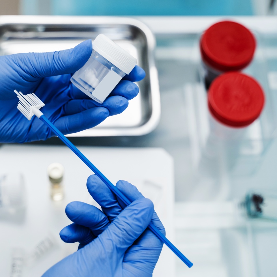 Gynecological cytology Pap smear test and cytobrush in hands of gynecologist. Gynecologist is holding flask for cytology Pap smear test in hands